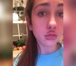3. Kylie Jenner Lip Challenge yang Gagal Total