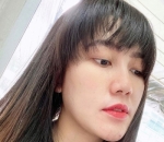 Via Vallen Sebelum Lakukan Perawatan, Sudah Cantik Ya