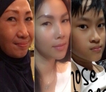 Foto Komplikasi Kemiripan