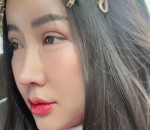 Wajah Masih Bengkak