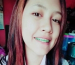 Pakai Behel Saat SMA