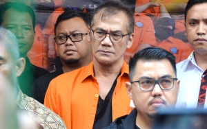 Gatal-Gatal, Tio Pakusadewo Keluhkan Air di Penjara