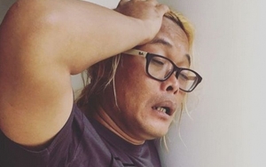 Tega, Ini Kondisi Sule Setelah Ngaku Disiksa Tim 'Ini Talkshow'