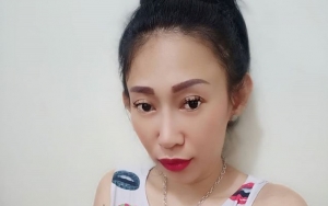 Dewi Sanca Curhat Dapat Luka Cakar Sampai Takut Mandi, Netter: Drama Banget