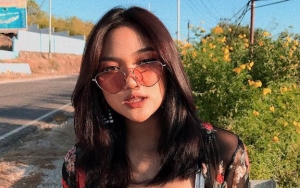 Foto Gigit Ibu Jari Tuai Cibiran Netter, Marion Jola Langsung Matikan Kolom Komentar