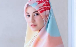 Wajah Natasha Rizki Kini Diserang Jerawat Parah, Ada Apa?