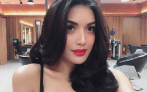 Pamer Foto Cantik, Ketiak Hitam Millendaru Jadi Sorotan