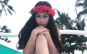 Wajah Ratu Felisha Dianggap Berubah dan Bikin Pangling, Netter: Cantikan Dulu