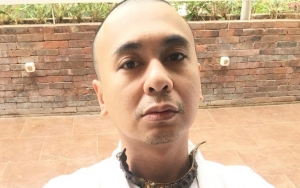 Unggah Foto Nostalgia, Wajah Culun dan Kumel Raditya Dika Jadi Sorotan