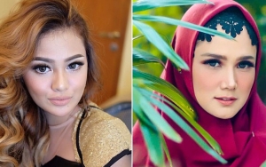  Foto Sebelum dan Sesudah Terkenal Dibandingkan, Aurel-Mulan Cs Bikin Pangling