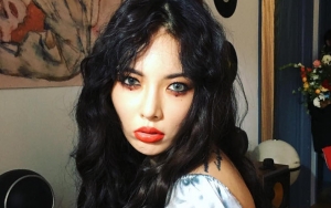 Pose Menggoda Pakai Lipstik Merah Tebal, HyunA Dicibir Seperti Wanita Murahan