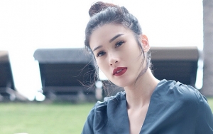 Stevianne Agnecya Baikan Pasca Tabrak Mobil, Warganet Temukan Kejanggalan Ini