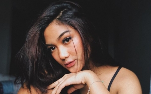 Bagikan Foto Selfie Cantik, Warganet Dibuat Salah Fokus ke Gigi Marion Jola  