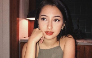 Bantah Lakukan Operasi Plastik Demi Cantik, Jennifer Coppen Dibela Netter