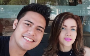 Video Barbie Kumalasari Tanam Benang Demi Wajah Cantik Bikin Ngilu, Netter Sindir Menyalahi Kodrat