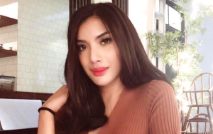 Makin 'Cantik' di Video Ini, Gigi Patah Millendaru Jadi Sorotan Netter