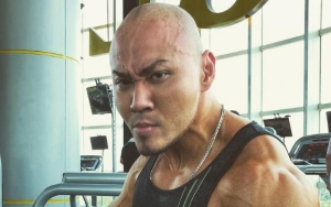 Tulang Tangan Copot dan Terkunci di Belikat, Deddy Corbuzier Akui Cacat Seumur Hidup