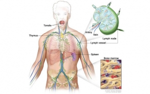 8 Tanda dan Cara Pengobatan Non-Hodgkin Lymphoma, Kanker yang Sebabkan Paul Allen Meninggal 