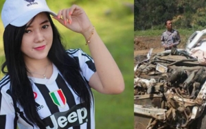 Koma 7 Hari, Model Cantik Rini Puspitawati Akhirnya Meninggal Dunia