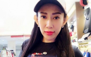 Usai Umbar Belahan Dada, Dewi Sanca Pamer Paha Belang Bikin Warganet Makin Miris