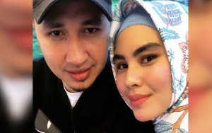 Kartika Putri Bahas Jerawat, Curiga Suami Tampan Rindukan Perempuan Lain?