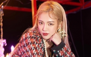 Ogah Jalani Operasi Plastik di Bagian Mata, Hyoyeon Malah Banjir Cibiran 