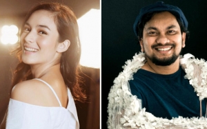 Chelsea Islan Cantik Kedipkan Mata, Begini Pendapat Tompi Sebagai Dokter