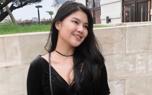 Pamer Pose Seksi, Kaki Belang Keponakan Dewi Persik Jadi Sorotan
