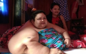 Viral Wanita dengan Berat 350 Kg di Kalteng, Rumah Sakit Lakukan Evakuasi Dengan Cara Khusus