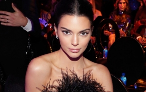 Jadi Model Termahal di Dunia, Kendall Jenner Ternyata Sempat Frustrasi Gara-Gara Jerawat