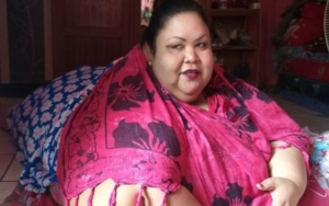 Hati-Hati Minum Obat Herbal Pelangsing Agar Tak Alami Seperti Titi Wati, Wanita Berbobot 220 kg