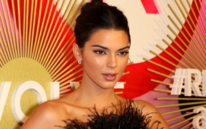 Ikut '10 Years Challenge', Kendall Jenner Tak Malu Pamer Jerawat