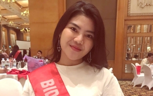 Kaki Rosa Meldianti Dibandingkan dengan Jessica Iskandar, Disindir Bak 'Kopi dan Susu'