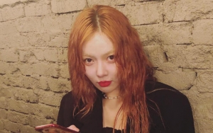HyunA Dikasihani Fans Usai Pamer Foto Lutut Lebam-Lebam