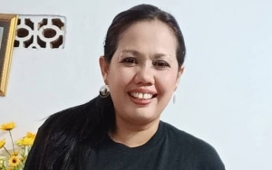 Tolak Pasang Behel, Ely Sugigi Lebih Pilih Jalani Tradisi Potong Gigi di Bali