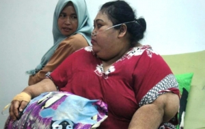 Bobot 148 Kg, Sunarti Penderita Obesitas Asal Karawang Meninggal Usai Berjuang Turunkan Berat Badan