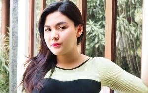 Wajah Vicky Shu di Foto Endorse Ini Dinilai Aneh, Disebut Editan Kurang Proporsional
