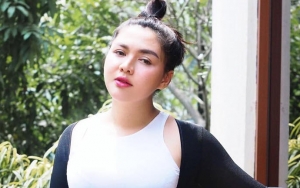 Vicky Shu Beri Penjelasan Soal Wajah Aneh Saat Foto Endorse, 'Tampar' Haters Pakai Selfie Cantik