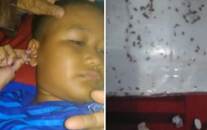 Viral Seorang Bocah Asal Majalengka Keluarkan Ratusan Semut dan Kertas Dari Telinga