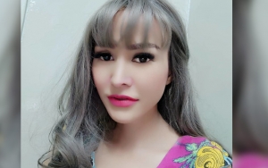 Model Seksi Cynthiara Alona Anggap Oplas Payudara Hal Wajar, Beberkan Alasan Demi Pundi-Pundi Rupiah