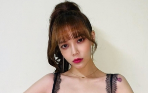 Jimin AOA Diyakini Oplas Rahang dan Dibilang Mirip Nenek-Nenek Usai Posting Foto Ini
