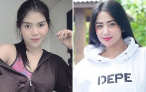 Meldi Kumat Joget Ular Nyontek Dewi Persik, Netter Ejek Sakit Jiwa Pamer Aura Jahat