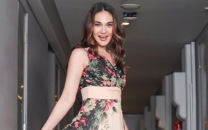 Luna Maya Pakai Perawatan Wajah Puluhan Juta, Dipuji Cantik Tanpa Operasi Plastik