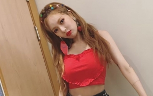 HyunA Kepeleset di Panggung dan Kepala Membentur Lantai Saat Nyanyikan 'Red', Begini Kondisinya