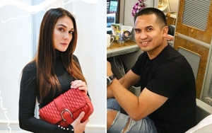 Luna Maya Manyun Cantik Pamer Flek Hitam dan Joget Bahagia, Faisal 'Kangen' Subuh-Subuh Ngelike