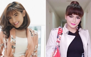 Angela Lee Pamer Luka Memar Jatuh Dari Tangga, Komentar Khawatir Dinar Candy Disorot