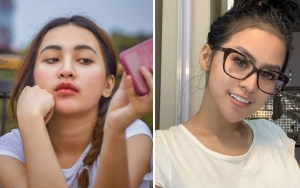 Cupi Cupita 'Ganas' Jambak-Cakar Teman Hingga Berdarah, Lia Callia: Dia Rebut Cowok dan Job Aku