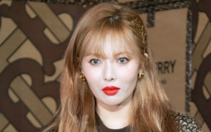 Wajah Terlihat Beda, Bibir Tebal HyunA Diyakini Hasil Suntik Filler