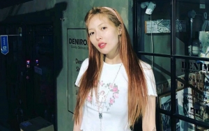 HyunA Lagi-Lagi Ngotot Bibir Tebalnya Bukan Hasil Suntik Filler Malah Dikasihani Netizen