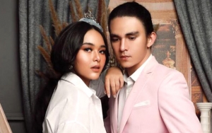 Amanda Manopo Pamer Cincin Tersemat di Jari Manis, Sudah Dilamar Christ Laurent?